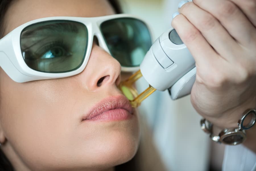 Patient undergoing laser hair removal treatment while wearing protective glasses